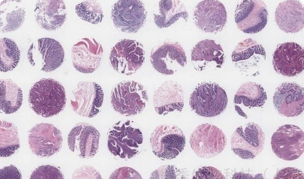 tissue array
